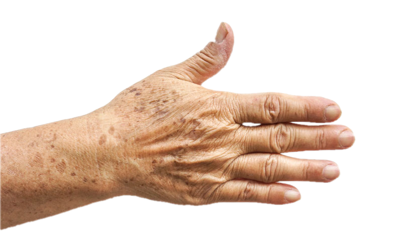 effects of aging prominent on hands