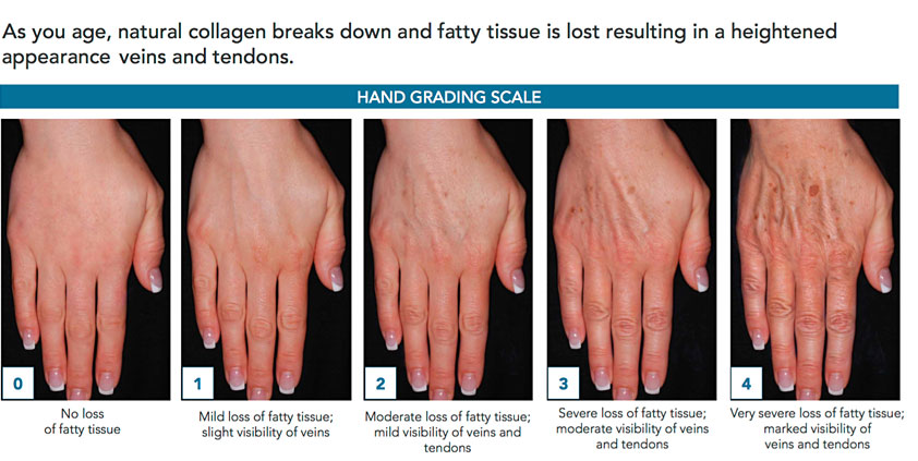 hands aging treatment