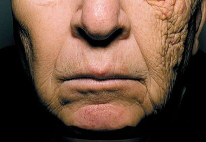 best skin aging treatment