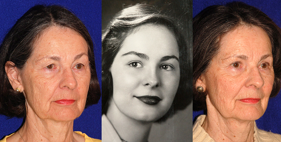 kimball jeanne pre post original