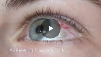 Eye Implant & Tattoos