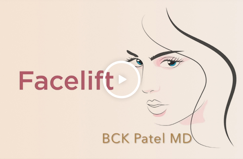 Facelift Video Procedure and Benefits BCK Patel