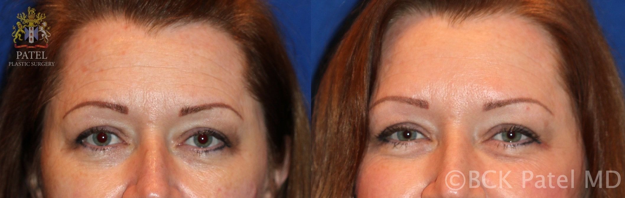 Anderson Michelle Three zones