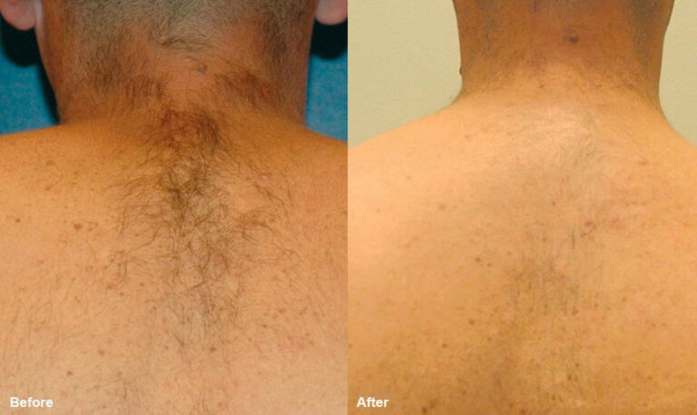 before-and-after-2_orig