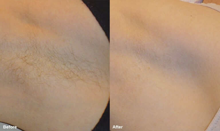 before-and-after-3_orig