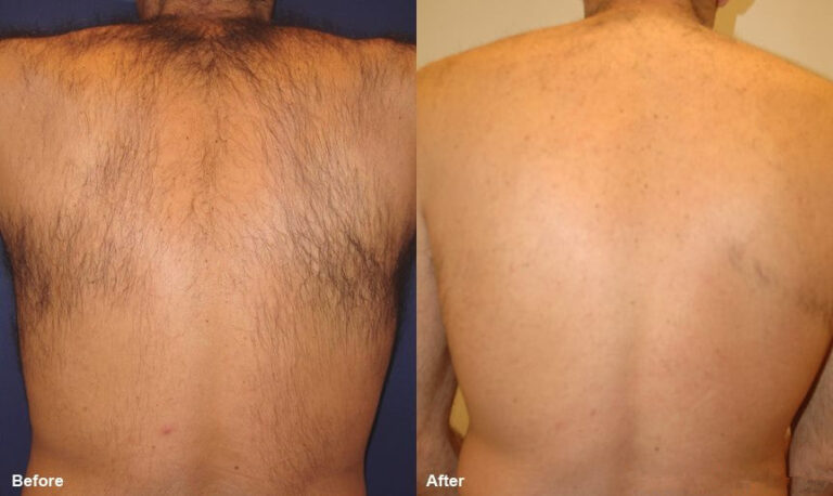 before-and-after-4_orig