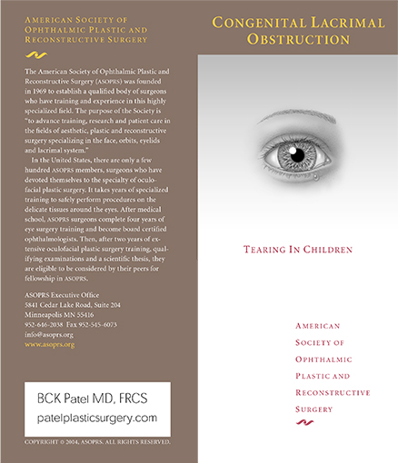 congenital lacrimal obstruction brochure