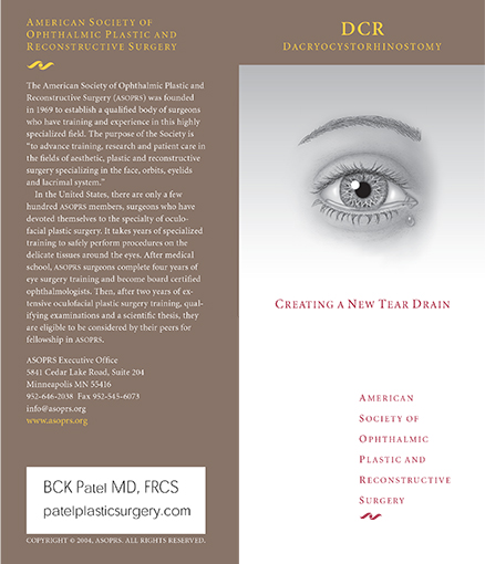 dacryocystorhynostomy brochure