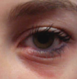 dennie-morgan-and-shiner