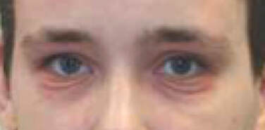 dennie-morgan-lines-adult