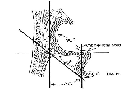 ear-anatomy-3_orig