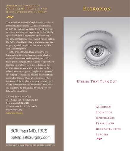 ectropion brochure