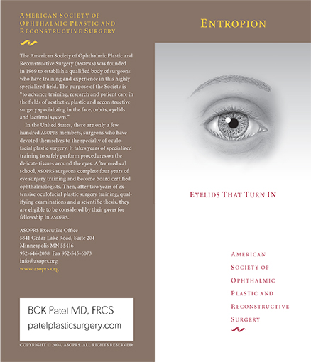 entropion brochure