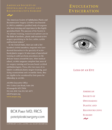 enucleation and evisceration brochure