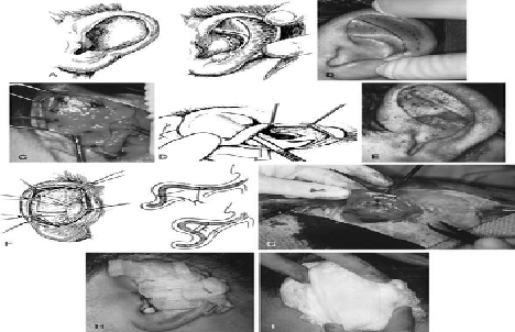Mustardé’s original technique