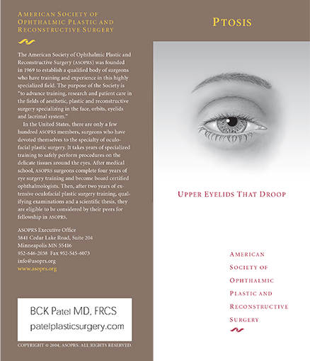 ptosis brochure