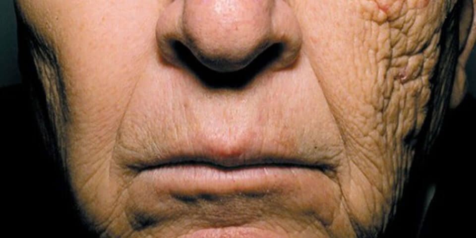 truck-driver-face-suppose-u-drive-sun-damage-to-skin