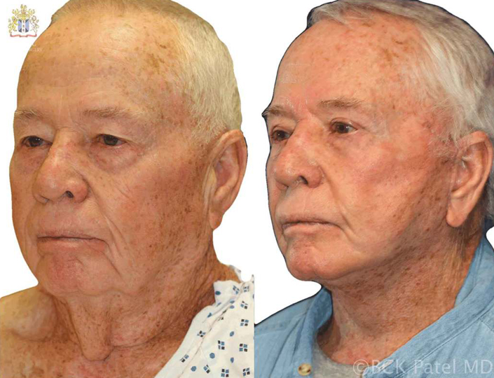 6-somerville-web_orig