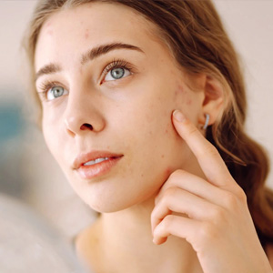 Young woman with problem skin looking into mirror