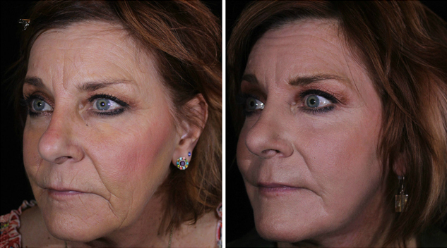 belinda-ba-april-2017-side-1