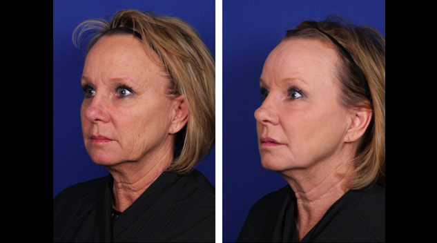 screen-shot-2017-04-19-at-7-13-56-pm