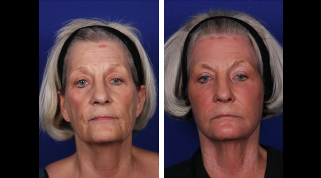 screen-shot-2017-04-19-at-7-14-05-pm