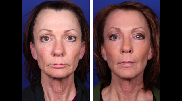 screen-shot-2017-04-19-at-7-14-50-pm