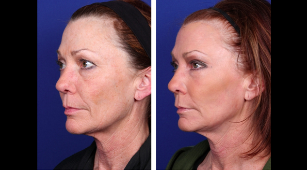 screen-shot-2017-04-19-at-7-14-57-pm