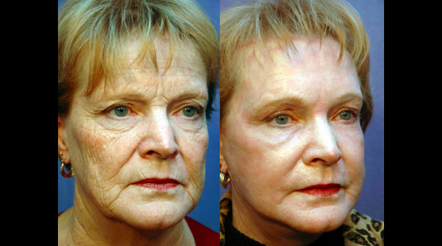 screen-shot-2017-07-06-at-12-34-29-pm