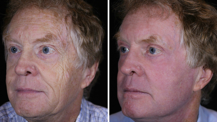 stan-after-8-weeks-left