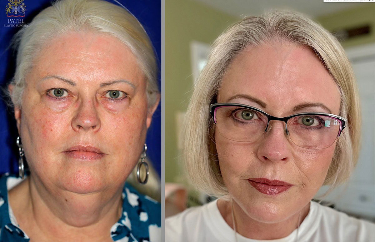 Age-60s-b