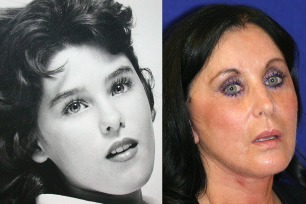 photographs from younger days patient image