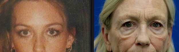 Aging over 30 years