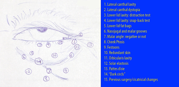 Assessment of the Aging Lower eyelid