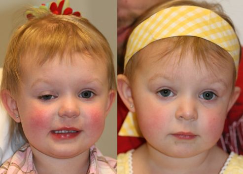 andersen-baylee-pre-post_orig