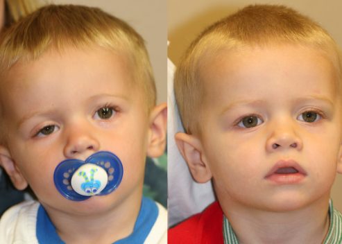 edmondson-gage-pre-post_orig