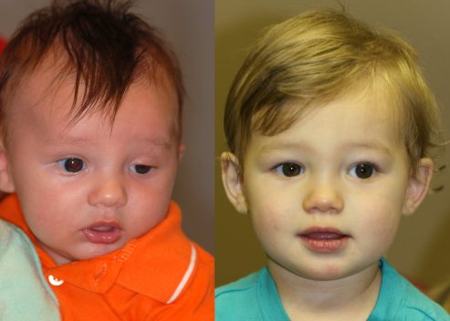 littlewood-rhett-pre-post_orig