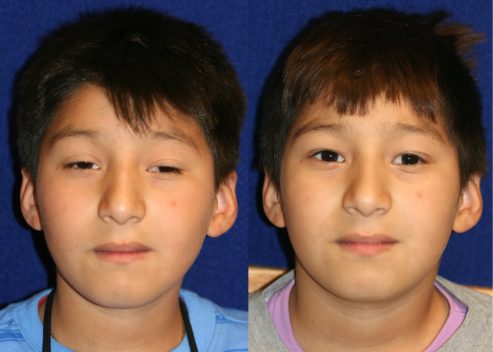 morales-bryan-pre-post_orig