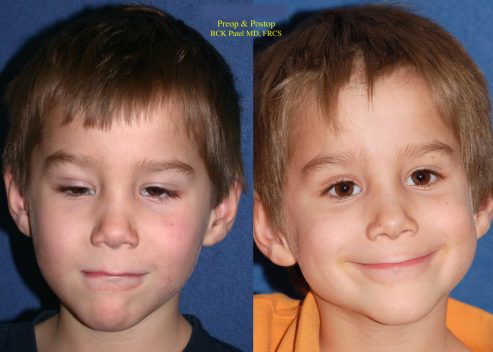 walker-benjamin-pre-post-1b_orig