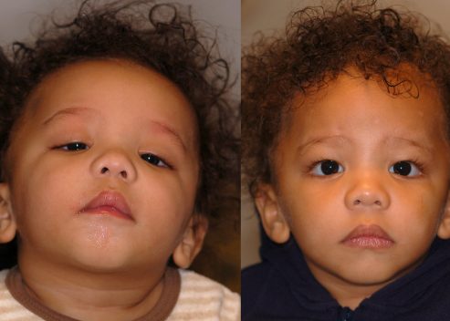 williams-raymond-pre-post-slings_orig